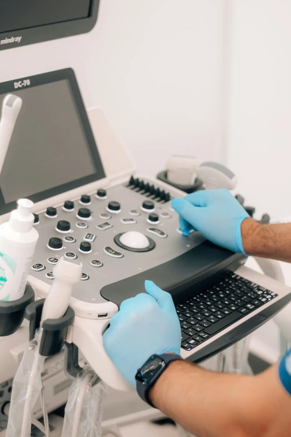 Ultrasound equipment used in fertility treatment planning