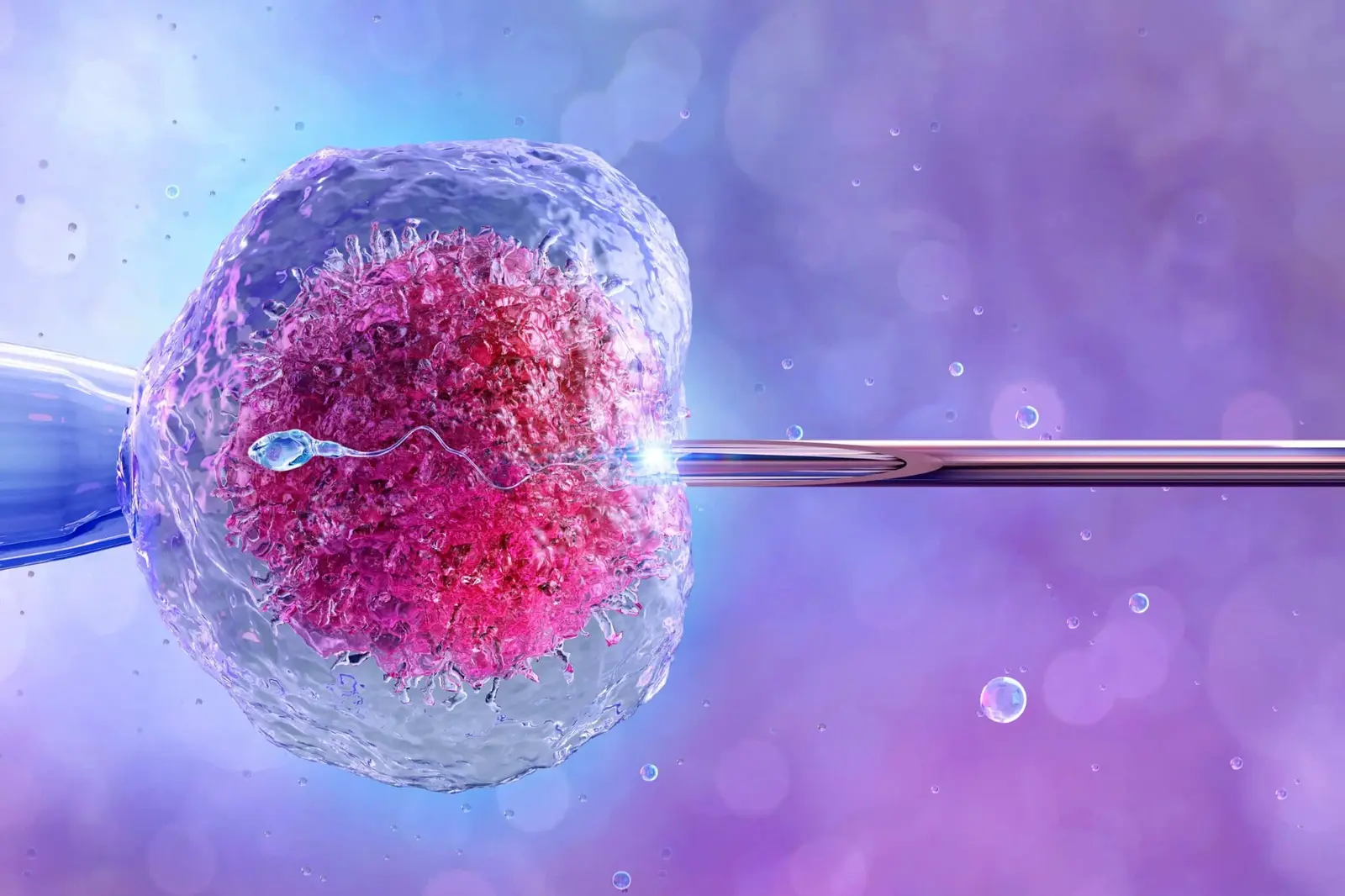 IVF fertilisation illustrating a carefully planned treatment journey