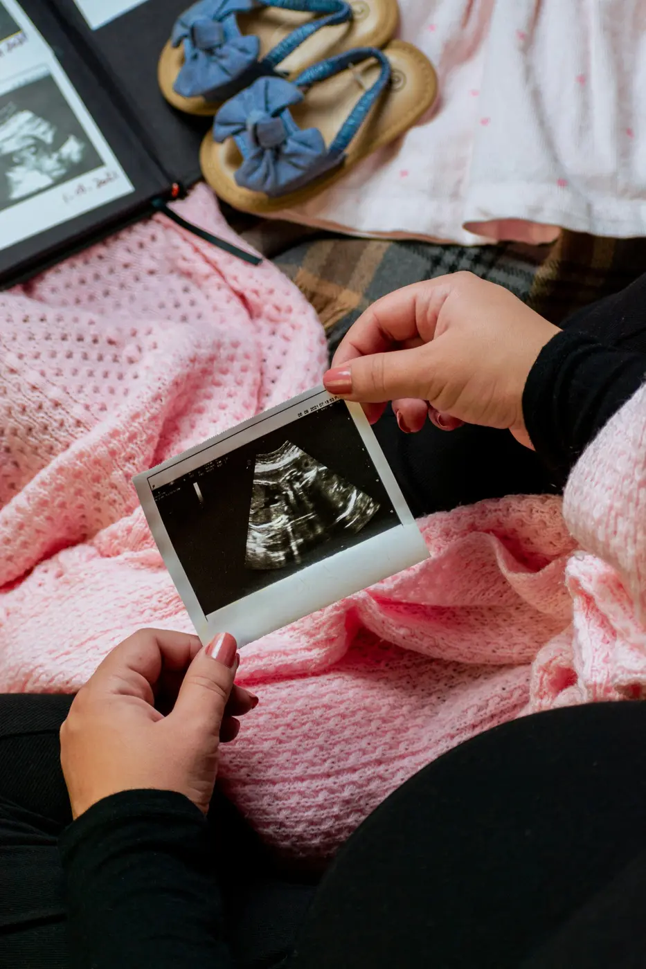 Reviewing an ultrasound image during fertility treatment planning